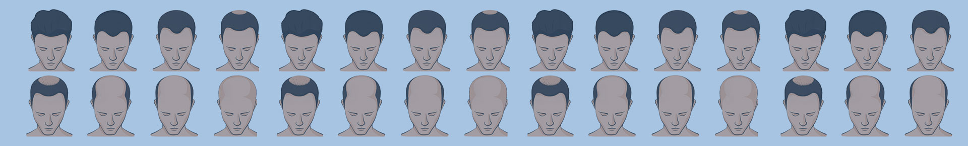 hairloss-banner