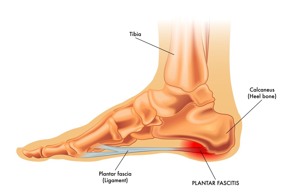 Foot and Ankle Pain Causes and Treatment - Beacon Law-totobed.com.vn